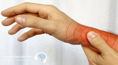 کاردرمانی برای ابتلا به آرتروز دست